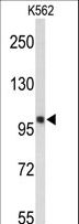 HSPH1 / HSP105 Antibody - Western blot of HSPH1 Antibody in K562 cell line lysates (35 ug/lane). HSPH1 (arrow) was detected using the purified antibody.