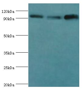 HSPH1 / HSP105 Antibody - Western blot. All lanes: Heat shock protein 105 kDa antibody at 1 ug/ml. Lane 1: MCF-7 whole cell lysate. Lane 2: HeLa whole cell lysate. Lane 3: mouse brain tissue. Secondary antibody: Goat polyclonal to rabbit at 1:10000 dilution. Predicted band size: 97 kDa. Observed band size: 97 kDa.