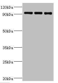 HSPH1 / HSP105 Antibody - Western blot All lanes: Heat shock protein 105 kDa antibody at 1µg/ml Lane 1: MCF-7 whole cell lysate Lane 2: Hela whole cell lysate Lane 3: Mouse brain tissue Secondary Goat polyclonal to rabbit IgG at 1/10000 dilution Predicted band size: 97, 93, 98 kDa Observed band size: 97 kDa