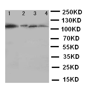 HSPH1 / HSP105 Antibody - WB of HSPH1 / HSP110 antibody. Lane 1: Rat Ovary Tissue Lysate. Lane 2: A549 Cell Lysate. Lane 3: U87 Cell Lysate . Lane 4: HELA Cell Lysate.