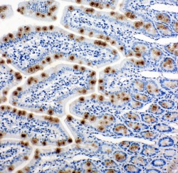 HSPH1 / HSP105 Antibody - HSPH1 / HSP110 antibody. IHC(P): Rat Intestine Tissue.