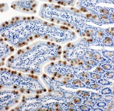 HSPH1 / HSP105 Antibody - HSPH1 / HSP110 antibody. IHC(P): Rat Intestine Tissue.