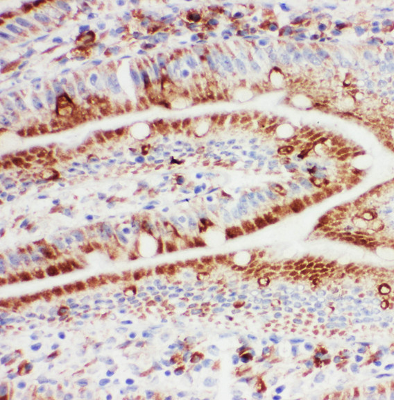 HSPH1 / HSP105 Antibody - HSPH1 / HSP110 antibody. IHC(F): Rat Intestine Tissue.
