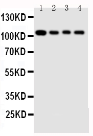 HSPH1 / HSP105 Antibody - Anti-Hsp105 antibody, Western blotting Lane 1: Rat Ovary Tissue Lysate Lane 2: A549 Cell Lysate Lane 3: U87 Cell Lysate Lane 4: HELA Cell Lysate