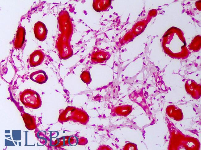 HSPH1 / HSP105 Antibody - Anti-HSP110 / Heat Shock Protein 110 antibody IHC of human breast. Immunohistochemistry of formalin-fixed, paraffin-embedded tissue after heat-induced antigen retrieval. Antibody concentration 5 ug/ml.  This image was taken for the unconjugated form of this product. Other forms have not been tested.