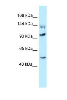 HSPH1 / HSP105 Antibody - HSPH1 / HSP105 antibody Western blot of Rat Brain lysate. Antibody concentration 1 ug/ml.  This image was taken for the unconjugated form of this product. Other forms have not been tested.