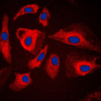 HSPH1 / HSP105 Antibody - Immunofluorescent analysis of HSPH1 staining in HeLa cells. Formalin-fixed cells were permeabilized with 0.1% Triton X-100 in TBS for 5-10 minutes and blocked with 3% BSA-PBS for 30 minutes at room temperature. Cells were probed with the primary antibody in 3% BSA-PBS and incubated overnight at 4 C in a humidified chamber. Cells were washed with PBST and incubated with a DyLight 594-conjugated secondary antibody (red) in PBS at room temperature in the dark. DAPI was used to stain the cell nuclei (blue).