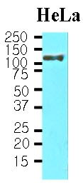 HSPH1 / HSP105 Antibody - Cell lysates of HeLa(30 ug) were resolved by SDS-PAGE, transferred to NC membrane and probed with anti-human HSP105 a (1:1000). Proteins were visualized using a goat anti-mouse secondary antibody conjugated to HRP and an ECL detection system.