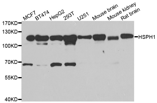 HSPH1 / HSP105 Antibody - Western blot analysis of extracts of various cell lines.