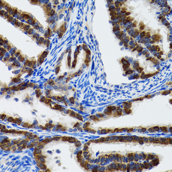 HSPH1 / HSP105 Antibody - Immunohistochemistry of paraffin-embedded rat fallopian tube tissue.