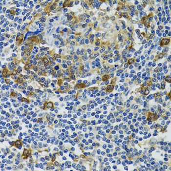 HSPH1 / HSP105 Antibody - Immunohistochemistry of paraffin-embedded human tonsil tissue.