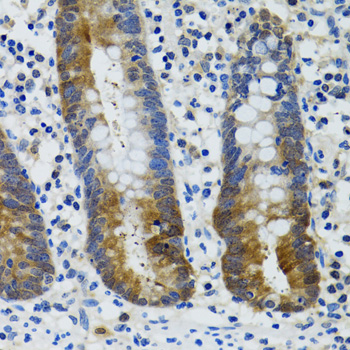 HSPH1 / HSP105 Antibody - Immunohistochemistry of paraffin-embedded human vermiform appendix tissue.