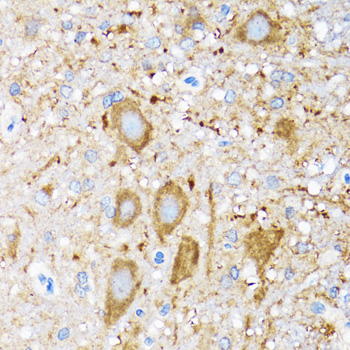 HSPH1 / HSP105 Antibody - Immunohistochemistry of paraffin-embedded mouse spinal cord tissue.