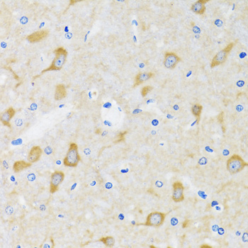 HSPH1 / HSP105 Antibody - Immunohistochemistry of paraffin-embedded mouse brain tissue.