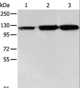 HSPH1 / HSP105 Antibody - Western blot analysis of PC3 cell, human colon cancer and liver cancer tissue, using HSPH1 Polyclonal Antibody at dilution of 1:500.