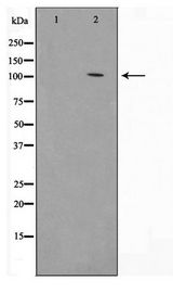 HSPH1 / HSP105 Antibody - Western blot of HeLa cell lysate using HSP105 Antibody