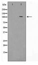 HSPH1 / HSP105 Antibody - Western blot of HeLa cell lysate using HSP105 Antibody