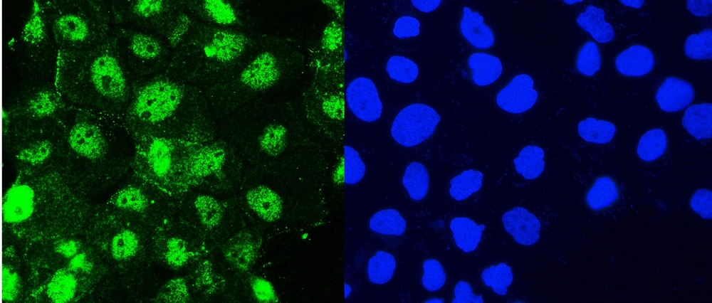 HSPH1 / HSP105 Antibody - IF analysis of Hsp105 using anti-Hsp105 antibody Hsp105 was detected in immunocytochemical section of U20S cells. Enzyme antigen retrieval was performed using IHC enzyme antigen retrieval reagent for 15 mins. The tissue section was blocked with 10% goat serum. The tissue section was then incubated with 2µg/mL rabbit anti-Hsp105 Antibody overnight at 4°C. DyLight®488 Conjugated Goat Anti-Rabbit IgG was used as secondary antibody at 1:100 dilution and incubated for 30 minutes at 37°C. The section was counterstained with DAPI. Visualize using a fluorescence microscope and filter sets appropriate for the label used.