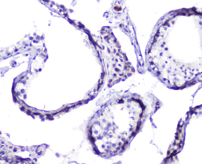 HSPH1 / HSP105 Antibody - IHC analysis of Hsp105 using anti-Hsp105 antibody. Hsp105 was detected in paraffin-embedded section of human testis tissues. Heat mediated antigen retrieval was performed in citrate buffer (pH6, epitope retrieval solution) for 20 mins. The tissue section was blocked with 10% goat serum. The tissue section was then incubated with 2µg/ml rabbit anti-Hsp105 Antibody overnight at 4°C. Biotinylated goat anti-rabbit IgG was used as secondary antibody and incubated for 30 minutes at 37°C. The tissue section was developed using Strepavidin-Biotin-Complex (SABC) with DAB as the chromogen.