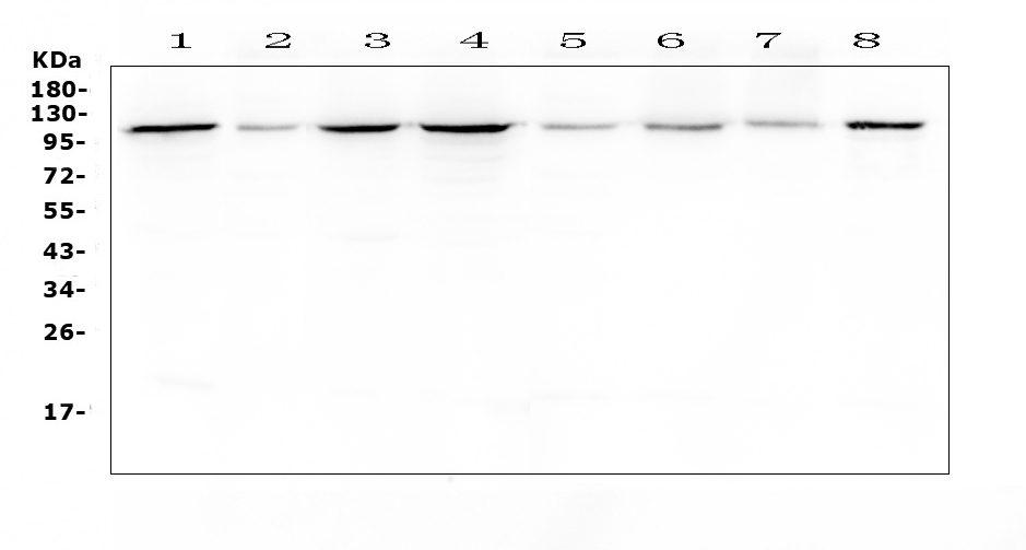 HSPH1 / HSP105 Antibody - Western blot analysis of Hsp105 using anti-Hsp105 antibody. Electrophoresis was performed on a 5-20% SDS-PAGE gel at 70V (Stacking gel) / 90V (Resolving gel) for 2-3 hours. The sample well of each lane was loaded with 50ug of sample under reducing conditions. Lane 1: human Hela whole cell lysates, Lane 2: human placenta tissue lysates, Lane 3: human COLO-320 whole cell lysates, Lane 4: human SGC-7901 whole cell lysates, Lane 5: human HepG2 whole cell lysates, Lane 6: human K562 whole cell lysates, Lane 7: human Jurkat whole cell lysates, Lane 8: human SK-OV-3 whole cell lysates. After Electrophoresis, proteins were transferred to a Nitrocellulose membrane at 150mA for 50-90 minutes. Blocked the membrane with 5% Non-fat Milk/ TBS for 1.5 hour at RT. The membrane was incubated with rabbit anti-Hsp105 antigen affinity purified polyclonal antibody at 0.5 µg/mL overnight at 4°C, then washed with TBS-0.1% Tween 3 times with 5 minutes each and probed with a goat anti-rabbit IgG-HRP secondary antibody at a dilution of 1:10000 for 1.5 hour at RT. The signal is developed using an Enhanced Chemiluminescent detection (ECL) kit with Tanon 5200 system. A specific band was detected for Hsp105 at approximately 105KD. The expected band size for Hsp105 is at 97KD.