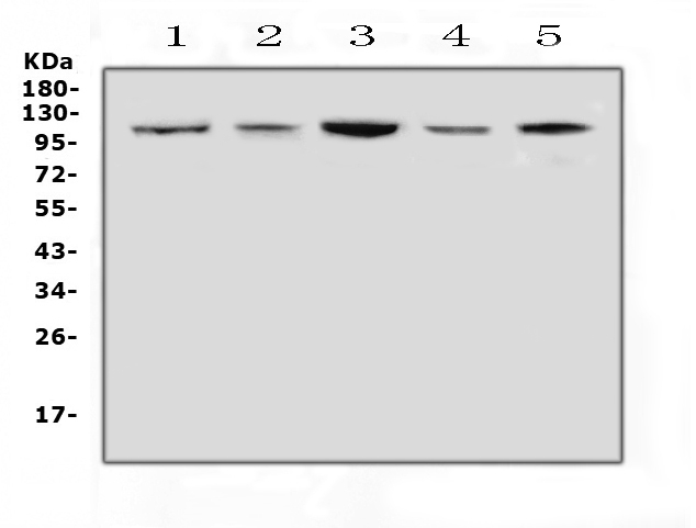 HSPH1 / HSP105 Antibody - Western blot analysis of Hsp105 using anti-Hsp105 antibody. Electrophoresis was performed on a 5-20% SDS-PAGE gel at 70V (Stacking gel) / 90V (Resolving gel) for 2-3 hours. The sample well of each lane was loaded with 50ug of sample under reducing conditions. Lane 1: rat brain tissue lysates, Lane 2: rat lung tissue lysates, Lane 3: mouse brain tissue lysates, Lane 4: mouse lung tissue lysates, Lane 5: mouse NIH3T3 whole cell lysates. After Electrophoresis, proteins were transferred to a Nitrocellulose membrane at 150mA for 50-90 minutes. Blocked the membrane with 5% Non-fat Milk/ TBS for 1.5 hour at RT. The membrane was incubated with rabbit anti-Hsp105 antigen affinity purified polyclonal antibody at 0.5 ?g/mL overnight at 4?C, then washed with TBS-0.1% Tween 3 times with 5 minutes each and probed with a goat anti-rabbit IgG-HRP secondary antibody at a dilution of 1:10000 for 1.5 hour at RT. The signal is developed using an Enhanced Chemiluminescent detection (ECL) kit with Tanon 5200 system. A specific band was detected for Hsp105 at approximately 105KD. The expected band size for Hsp105 is at 97KD.