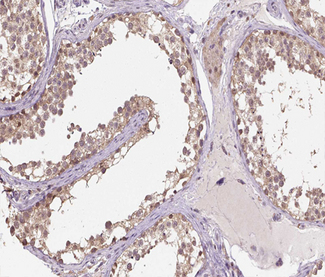 HSPH1 / HSP105 Antibody - 1:100 staining human Testis tissue by IHC-P. The tissue was formaldehyde fixed and a heat mediated antigen retrieval step in citrate buffer was performed. The tissue was then blocked and incubated with the antibody for 1.5 hours at 22°C. An HRP conjugated goat anti-rabbit antibody was used as the secondary.