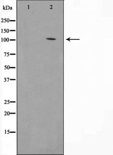 HSPH1 / HSP105 Antibody - Western blot analysis on HeLa cell lysates using HSP105 antibody. The lane on the left is treated with the antigen-specific peptide.