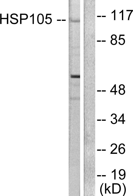 HSPH1 / HSP105 Antibody - Western blot analysis of extracts from HeLa cells, using HSP105 antibody.