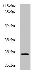 HsT19268 / MTHFS Antibody - Western blot All lanes: MTHFS antibody at 2µg/ml Lane 1: Hela whole cell lysate Lane 2: jurkat whole cell lysate Secondary Goat polyclonal to rabbit IgG at 1/10000 dilution Predicted band size: 24, 21 kDa Observed band size: 24 kDa