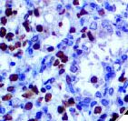 HSV-1 / Herpes Simplex Virus 1 Antibody - IHC of Herpes Simplex Virus I on FFPE Infected Tissue. This image was taken for the unmodified form of this product. Other forms have not been tested.
