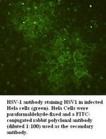 HSV-1 / Herpes Simplex Virus 1 Antibody