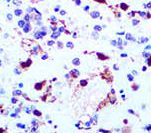 HSV-1 / Herpes Simplex Virus 1 Antibody - IHC of HSV I on FFPE Infected tissue. This image was taken for the unmodified form of this product. Other forms have not been tested.