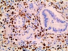 HSV / Herpes Simplex Virus Antibody - IHC of HSV I & II on a FFPE Infected Tissue