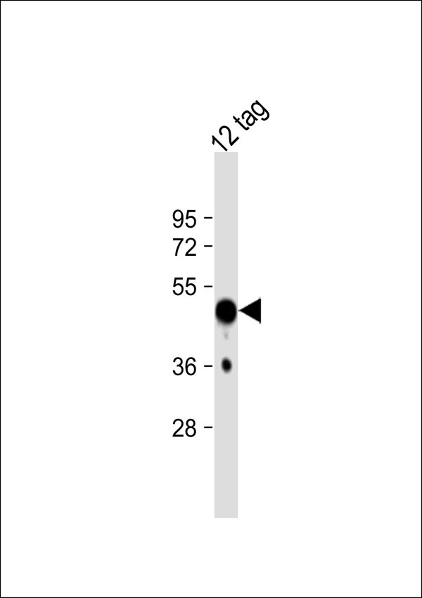 HSV Tag Antibody - Anti-HSV Tag Antibody at 1:1000 dilution + 12-tag protein lysate Lysates/proteins at 20 ug per lane. Secondary Goat Anti-Rabbit IgG, (H+L), Peroxidase conjugated at 1:10000 dilution. Predicted band size: 45 kDa. Blocking/Dilution buffer: 5% NFDM/TBST.
