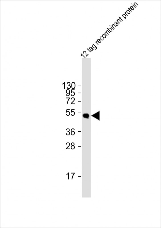 HSV Tag Antibody - Anti-HSV tag Antibody at 1:2000 dilution + 12 tag recombinant protein lysate Lysates/proteins at 20 µg per lane. Secondary Goat Anti-Rabbit IgG, (H+L), Peroxidase conjugated at 1/10000 dilution. Predicted band size: 42 kDa Blocking/Dilution buffer: 5% NFDM/TBST.