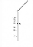HSV Tag Antibody - Anti-HSV tag Antibody at 1:2000 dilution + 12 tag recombinant protein lysate Lysates/proteins at 20 µg per lane. Secondary Goat Anti-Rabbit IgG, (H+L), Peroxidase conjugated at 1/10000 dilution. Predicted band size: 42 kDa Blocking/Dilution buffer: 5% NFDM/TBST.
