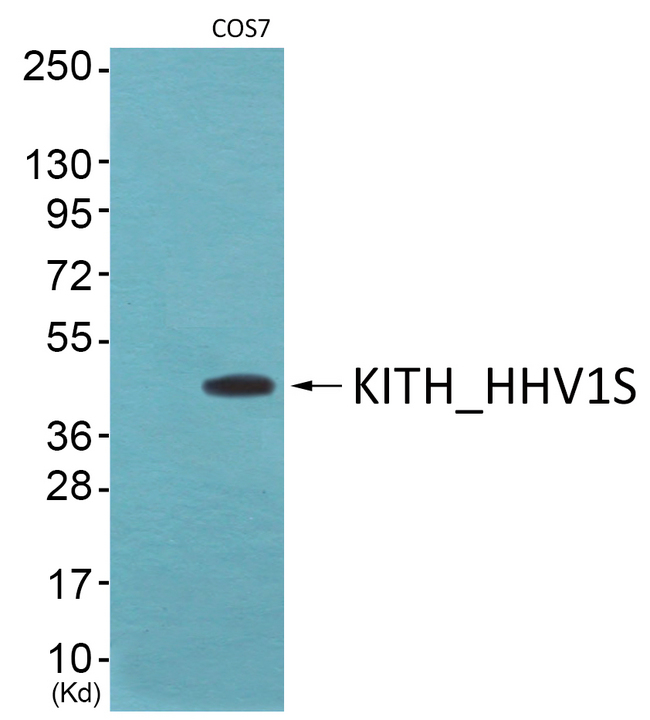 HSV-TK Antibody - Western blot of extracts from COS7 cells, using KITH_HHV1S antibody.