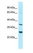 HT036 / HYI Antibody - HT036 / HYI antibody Western Blot of U937.  This image was taken for the unconjugated form of this product. Other forms have not been tested.