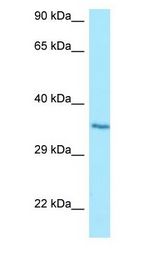 HT036 / HYI Antibody - HT036 / HYI antibody Western Blot of Jurkat.  This image was taken for the unconjugated form of this product. Other forms have not been tested.