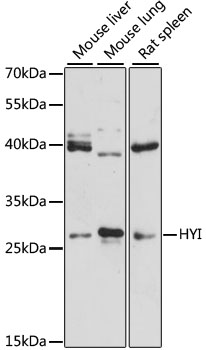 HT036 / HYI Antibody - Western blot analysis of extracts of various cell lines, using HYI antibody at 1:3000 dilution. The secondary antibody used was an HRP Goat Anti-Rabbit IgG (H+L) at 1:10000 dilution. Lysates were loaded 25ug per lane and 3% nonfat dry milk in TBST was used for blocking. An ECL Kit was used for detection and the exposure time was 90s.