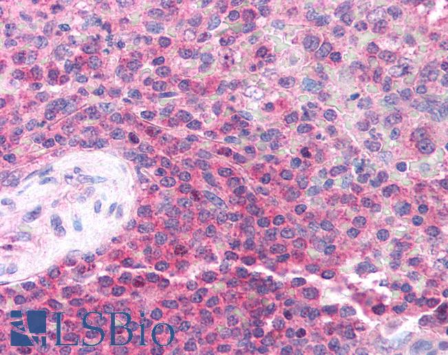 HT2A / TRIM32 Antibody - Anti-TRIM32 antibody IHC of human spleen. Immunohistochemistry of formalin-fixed, paraffin-embedded tissue after heat-induced antigen retrieval. Antibody concentration 5 ug/ml.  This image was taken for the unconjugated form of this product. Other forms have not been tested.