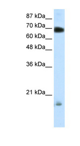 HT2A / TRIM32 Antibody - TRIM32 antibody Western blot of Transfected 293T cell lysate. This image was taken for the unconjugated form of this product. Other forms have not been tested.