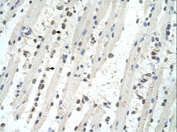 HT2A / TRIM32 Antibody - TRIM32 antibody TRIM32(tripartite motif-containing 32) Antibody was used in IHC to stain formalin-fixed, paraffin-embedded human muscle.  This image was taken for the unconjugated form of this product. Other forms have not been tested.