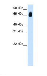 HT2A / TRIM32 Antibody - Transfected 293T cell lysate. Antibody concentration: 1.25 ug/ml. Gel concentration: 12%.  This image was taken for the unconjugated form of this product. Other forms have not been tested.