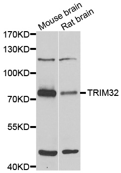 HT2A / TRIM32 Antibody - Western blot analysis of extracts of various cell lines.