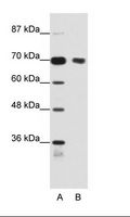 HT2A / TRIM32 Antibody - A: Marker, B: Jurkat Cell Lysate.  This image was taken for the unconjugated form of this product. Other forms have not been tested.