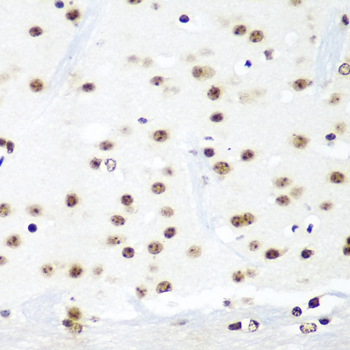 HTATSF1 / TAT-SF1 Antibody - Immunohistochemistry of paraffin-embedded mouse brain tissue.