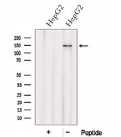 HTATSF1 / TAT-SF1 Antibody - Western blot analysis of extracts of HepG2 cells using HTATSF1 antibody. The lane on the left was treated with blocking peptide.