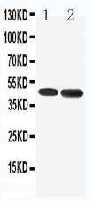 HTR1A / 5-HT1A Receptor Antibody - WB of HTR1A / 5-HT1A Receptor antibody. All lanes: Anti-HTR1A at 0.5ug/ml. Lane 1: Rat Brain Tissue Lysate at 40ug. Lane 2: Human U87 Whole Cell Lysate at 40ug. Predicted bind size: 46KD. Observed bind size: 46KD.