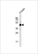 HTR1A / 5-HT1A Receptor Antibody - Anti-5-HT1A Antibody at 1:1000 dilution + human brain lysates Lysates/proteins at 20 ug per lane. Secondary Goat Anti-Rabbit IgG, (H+L),Peroxidase conjugated at 1/10000 dilution Predicted band size : 46 kDa Blocking/Dilution buffer: 5% NFDM/TBST.